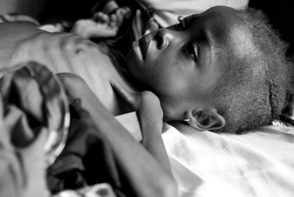Sick kid Africa Sierra leone masanga